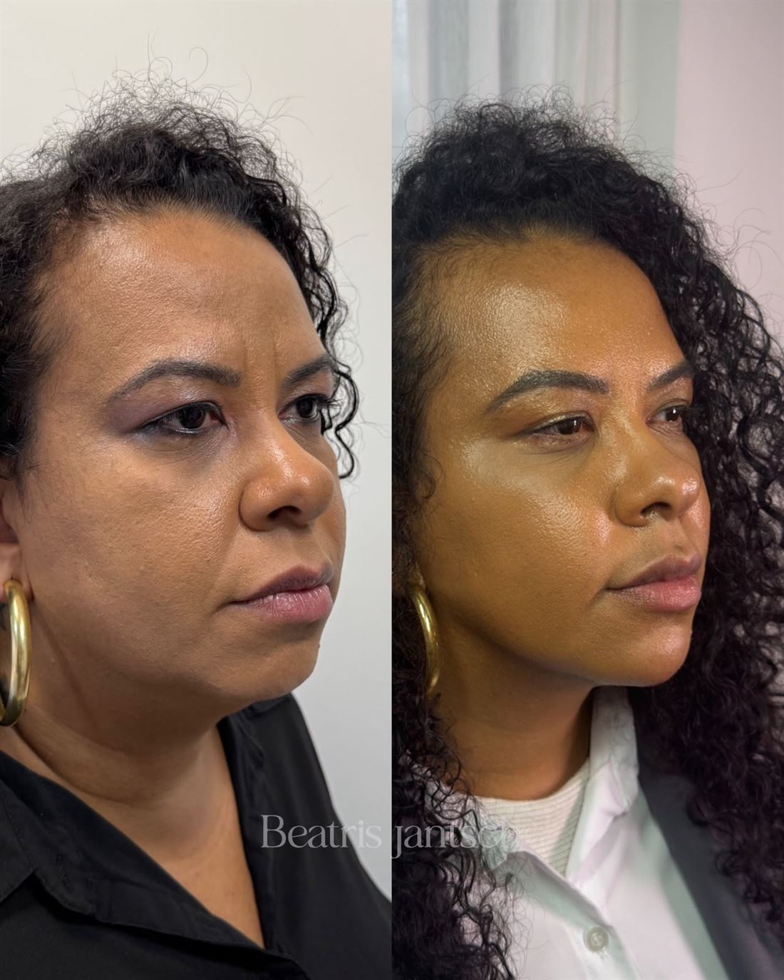 Antes e depois — caso 6